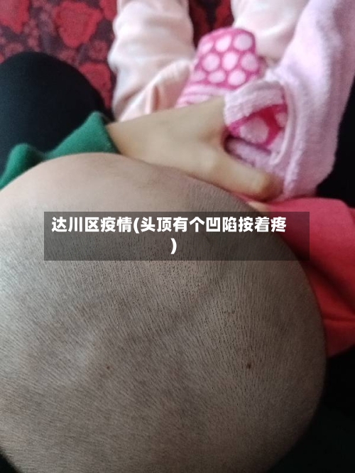 达川区疫情(头顶有个凹陷按着疼)-第3张图片