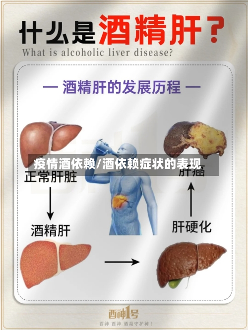 疫情酒依赖/酒依赖症状的表现