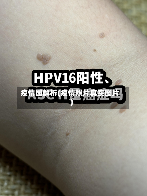 疫情图解析(疫情照片真实图片)