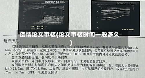 疫情论文审核(论文审核时间一般多久)