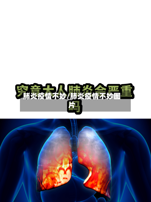 肺炎疫情不妙/肺炎疫情不妙图片-第2张图片