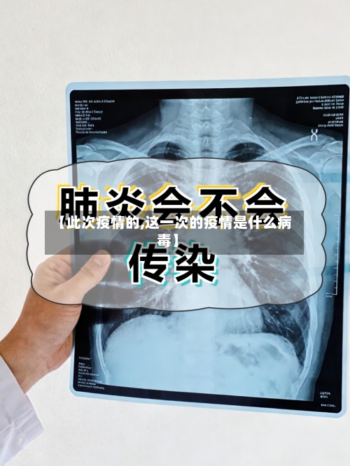 【此次疫情的,这一次的疫情是什么病毒】